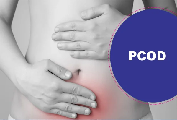 PCOD
