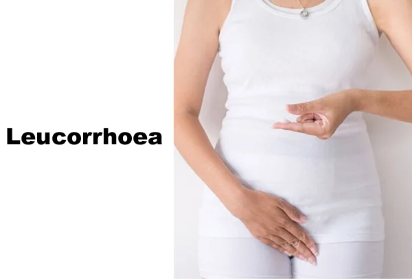 Leucorrhoea