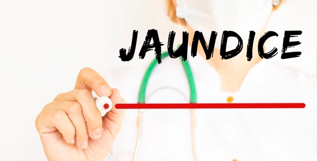 Natural Treatment For Jaundice