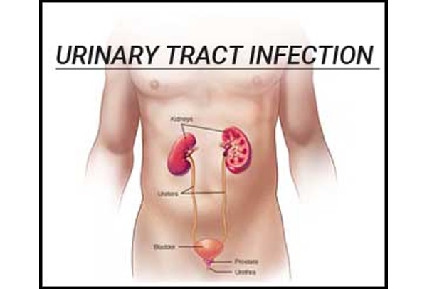 Natural Treatment For UTI